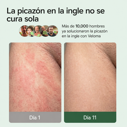 Decile adiós a los hongos que siempre vuelven.